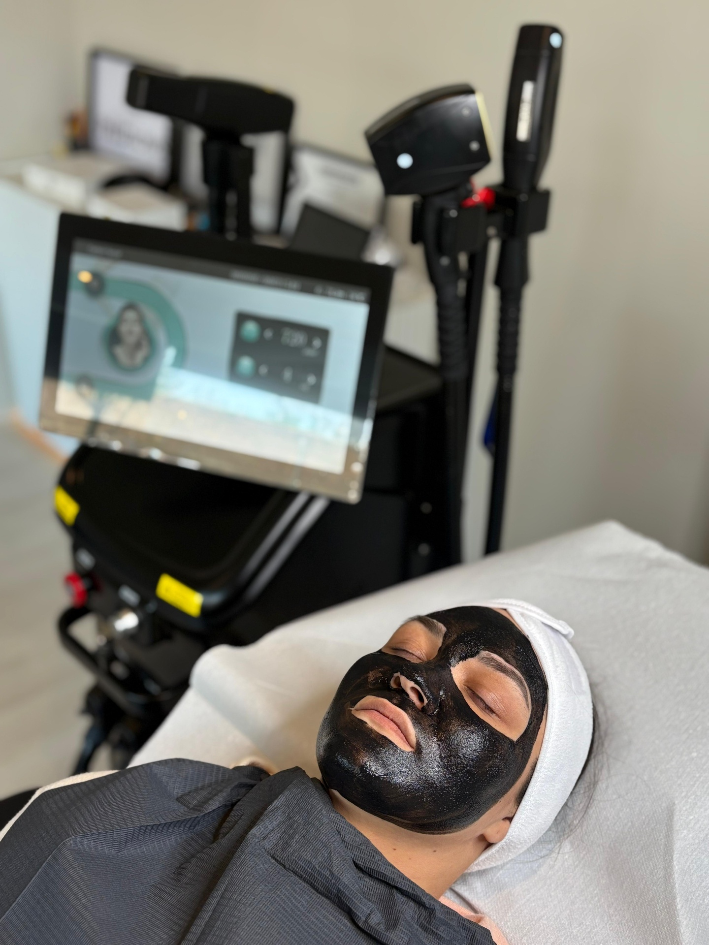 Stap 1 — Carbon masker aangebracht